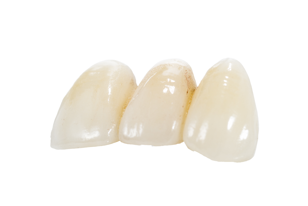 Corona de zirconio / Diente natural / Sobre implante Corona de zirconio / Diente natural / Sobre implante