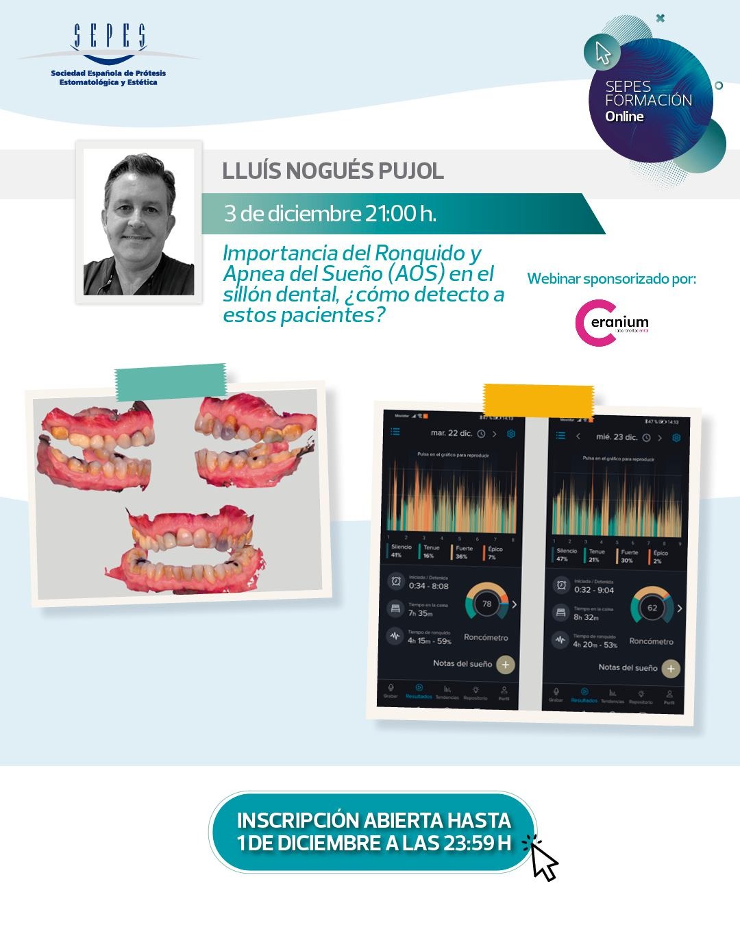 Detección del ronquido y la apnea del sueño desde la consulta dental