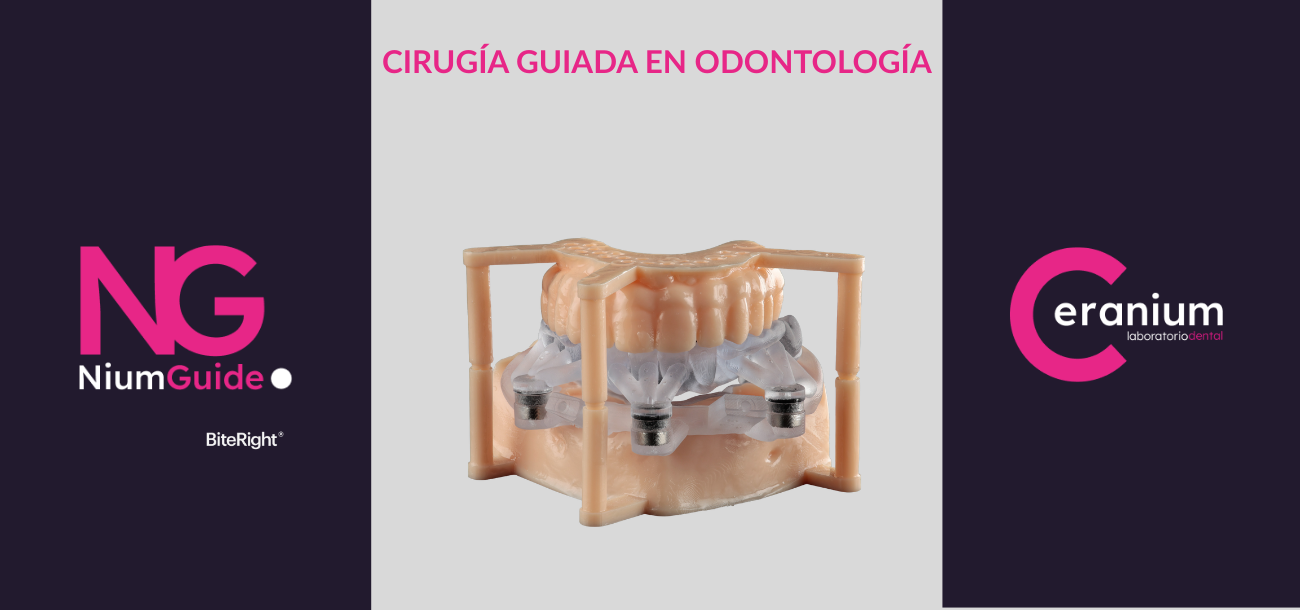 La implantología digital permite obtener resultados más predecibles, minimizar riesgos y mejorar la experiencia del paciente con Nium Guide, powered by Biteright.