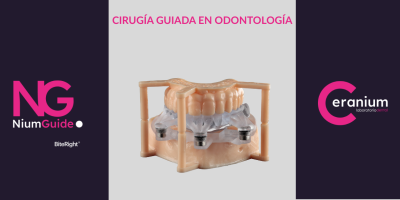 La implantología digital permite obtener resultados más predecibles, minimizar riesgos y mejorar la experiencia del paciente con Nium Guide, powered by Biteright.